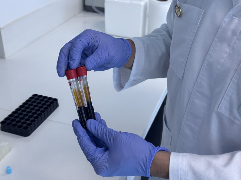 Prueba de detección temprana de cáncer se llama Oncoseek. Foto: créditos Jenniffer Jiménez.