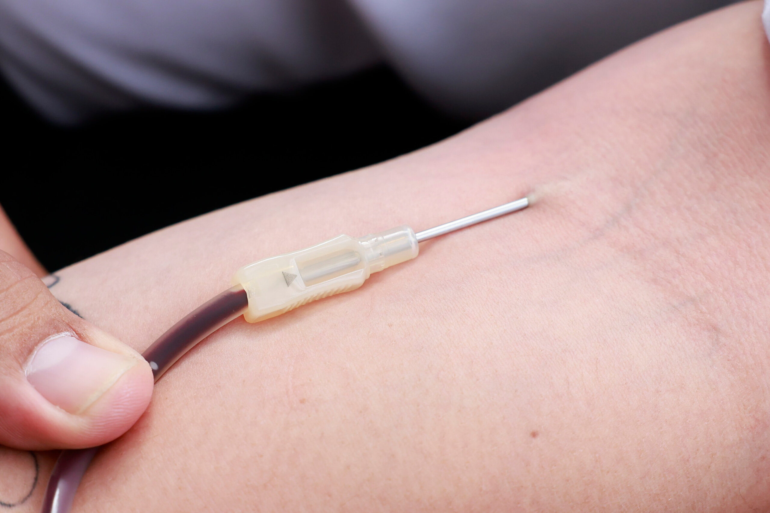 Día mundial de la hemofilia: ¿Cómo detectar señales?