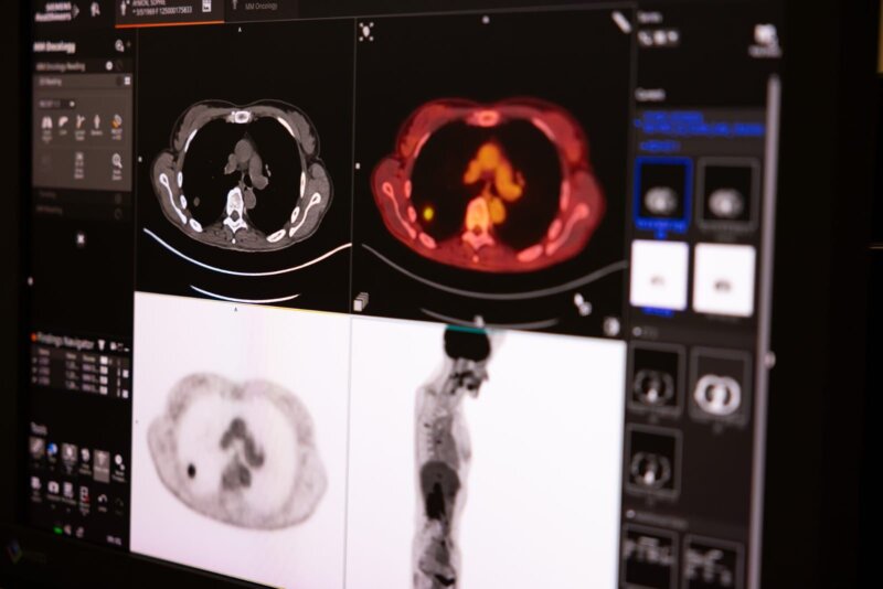 Diagnóstico del cáncer de próstata. Foto: UCR.