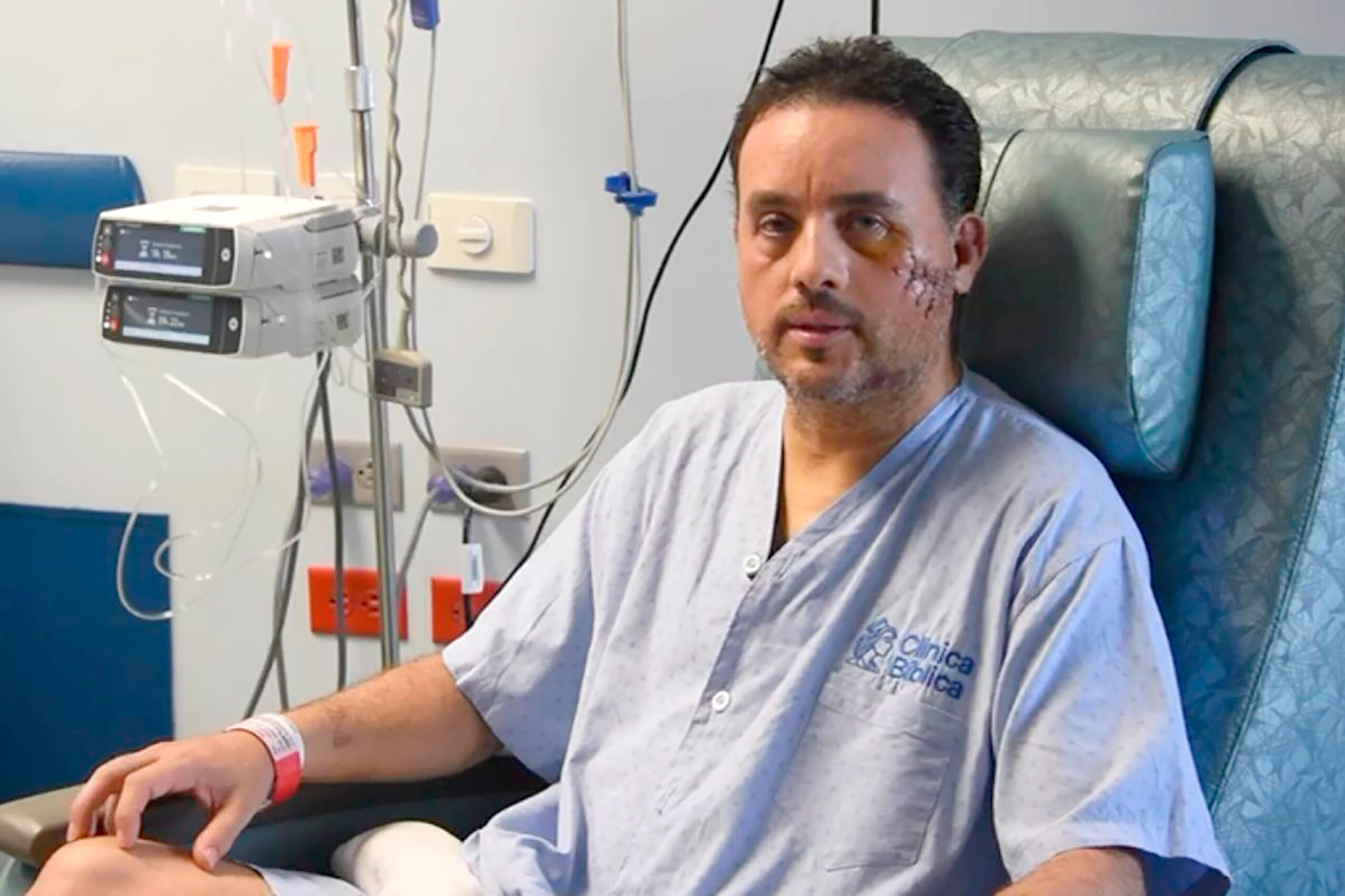 Biólogo atacado por tiburón vuelve al mar a defenderlo